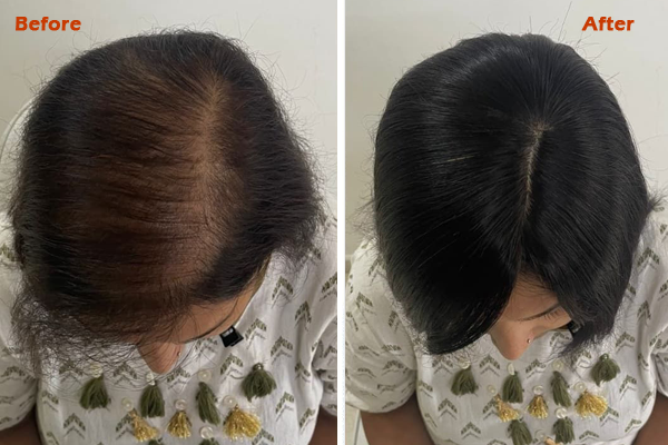 after before