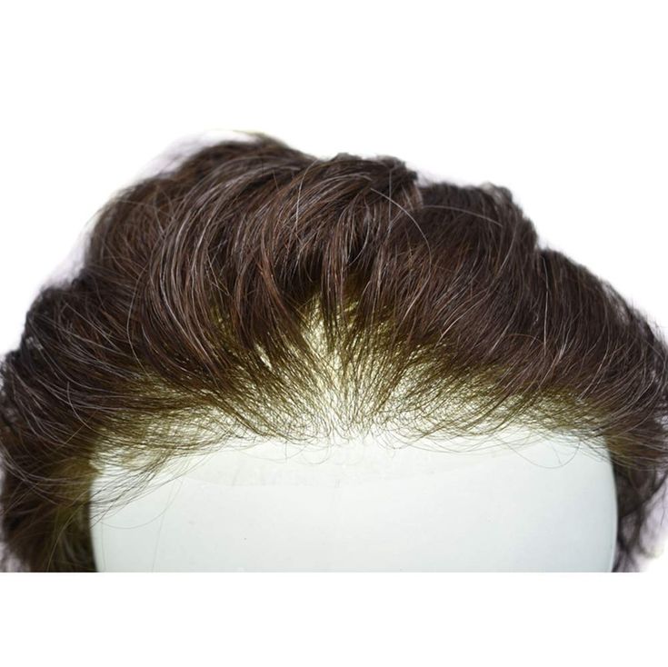 Australia Hair Patch