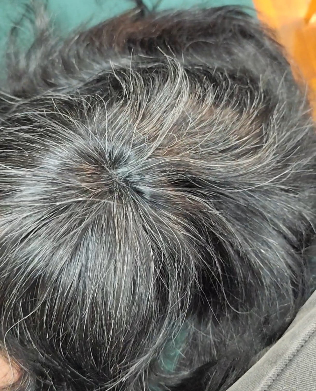 Salt & Pepper Hair Patch for Men
